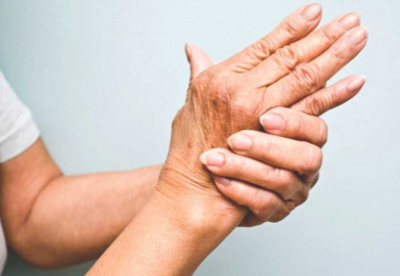 psoriatic arthritis